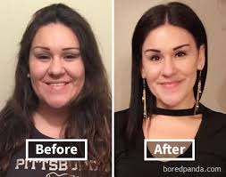 Pin On Before And After Success