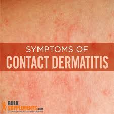 Image result for contact dermatitis