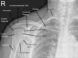 Image result for Snapping Scapula
