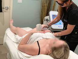 Facials, microblading, weight loss, acupuncture, laser hair removal, mole removal, tattoo removal, acne scars, vein removal in yyc. Laser Hair Removal Skinpossible Medical Aesthetics Clinic