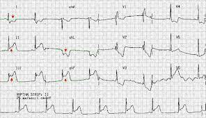 We did not find results for: Belajar Ekg Cepat 20 Menit Gratiss Belajarekg