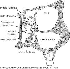 Image result for Maxillary Sinus