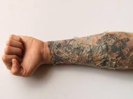 If you suspect that you developed an allergy to the ink used in your tattoo, there's not a lot that you can do to make it stop. What To Do When Tattoo Peels The Peeling And Healing Process