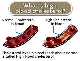 In fact, the higher your blood cholesterol level, the greater your risk for developing heart disease or having a heart attack. What Is High Blood Cholesterol Circlecare