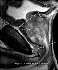 Measurement Of Prostate Volume With Mri A Guide For The Perplexed Biproximate Method With Analysis Of Precision And Accuracy Scientific Reports