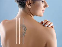 Better off offers noninvasive laser tattoo removal, cellulite & fat removal, ultrasound body contouring, skin rejuvenation and acne scar removal. Tattoo Removal Online Education National Laser Institute