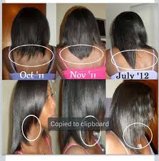 Biotin Pills Hair Growth Results Before And After Hairfinity Results Hair Growth Pills Hair Vitamins Hairfinity