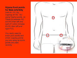 Facebook Male Infertility Hijama Cupping Therapy