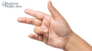 Image result for Trigger Finger