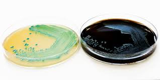 Listeria is a genus of bacteria that acts as an intracellular parasite in mammals. Testing For Listeria Spp Listeria Monocytogenes In Food In 6h Tentamus