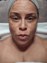 Hydrafacial by @alisha_monique_ that last pic REALLY captured that Marie  Curie glow I adore 🥰🤪