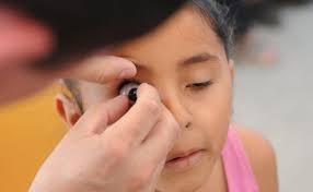 Prótesis ocular gratis