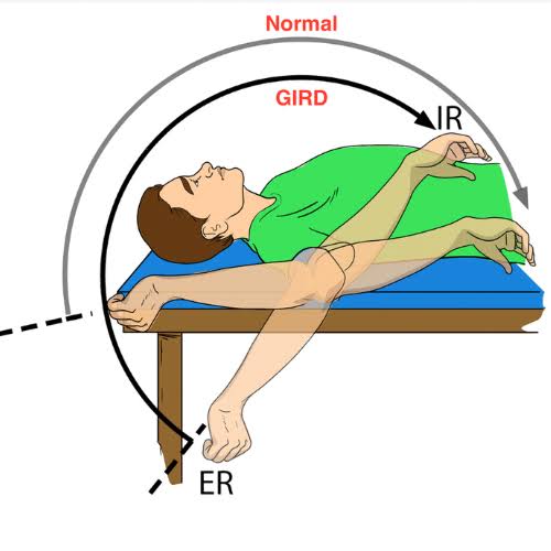 Everything You Need to Know About Glenohumeral Internal Rotation Deficit ( GIRD) and How to Find Relief - Cole Pain Therapy Group