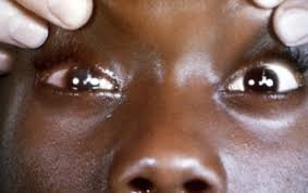 Image result for Pseudoeriosema