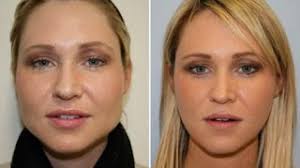 Kalau mahu cantik, ramai yang sanggup buat apa sahaja. Jom Follow Tips Ini Untuk Kuruskan Pipi Tembam Anda Beautifulnaara