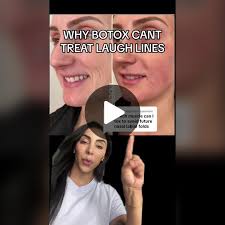 Replying to @Stoicism why botox cant treat laugh lines! To understand ...
