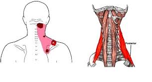 Pin On Neck And Shoulder Pain