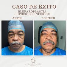 Claudia Mateo de Oleo 🏅| Dermatóloga (@dermmateo) • Instagram photos and  videos