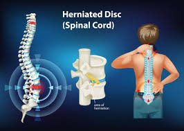 This presentation's focus is on the distribution. Premium Vector Human Spine Bones Anatomy Sketch Of Skeleton Backbone Or Vertebral Column Cervical Thoracic And Lumbar Vertebrae Pelvic Curvature And Coccyx Rib Facet Intervertebral Discs And Foramen