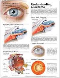 Understanding Glaucoma Anatomical Chart Anatomical Chart