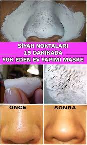 Siyah Noktalari 15 Dakikada Yok Eden Jelatin Maskesi Evde Nasil Yapilir Siyah Noktalar Jelatin Dogal Cilt Bakimi