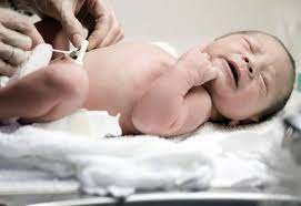 Delayed Cord Clamping Pros Cons Women Fitness