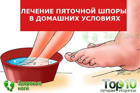 как избавиться от запаха ног навсегда в домашних условиях Top 10 Metodov Lecheniya Pyatochnoj Shpory V Domashnih Usloviyah Proverennye Recepty Kak Vylechit Pyatochnuyu Shporu Na Domu Pyatochnaya Shpora Bol V Pyatke Tovary Dlya Zdorovya