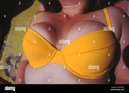Large sunburnt boobs in yellow bikini Stock Photo - Alamy