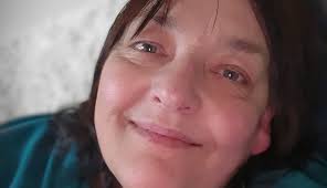 Lost a baby from anencephaly and spina bifida or any condition