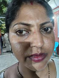 Subject: Rescue of Naked Abnormal Homeless Man in Tilakwadi Area* Dear Sir,  This is to bring to your attention that a naked and mentally disturbed  homeless man was found sitting