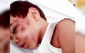 Pai denuncia que há 6 anos filho caiu do mesmo toboágua onde menino morreu  em parque aquático de Caldas Novas