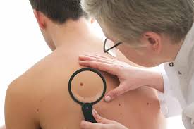 Can you spots the signs? Frequently Asked Questions About Skin Cancer Medical Centre