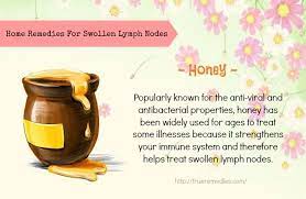 32 Home Remedies For Swollen Lymph Nodes In Neck And Throat Swollen Lymph Nodes Lymph Nodes Home Remedies