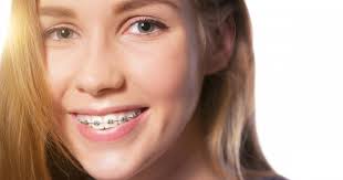 Maybe you would like to learn more about one of these? How Braces Help Get A Perfect Smile Academy Dental Cosmetic Dentists