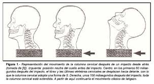 Jul 02, 2021 · casi todos los cánceres cervicales son causados por el virus del papiloma humano (vph). Revision Critica Sobre El Sindrome Del Latigazo Cervical I De Veras Existe Una Lesion Anatomica