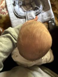  Cranial نمو رأس رضيعك بشكل طبيعي