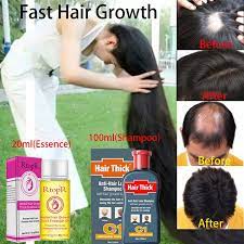 Buy anti hair loss shampoo hair loss treatment hair thickner fast hair growth serum hair care products hair growth essence serum oil from smeshmega.com now with great discounts and worldwide delivery the huge store with 10,000+ products Want Longer Hair Buy 20ml Essence 100ml Shampoo Effective Fast Hair Growth Fluid Anti Hair Loss Treatment Hair Growth Hair Growth Liquid Wish