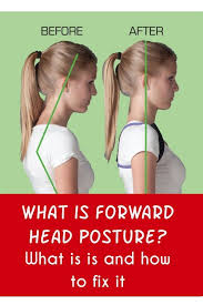 How To Correct Forward Head Posture Forward Head Posture Correction Forward Head Posture Brace Forward Head Posture Forward Head Posture Exercises Posture Neck