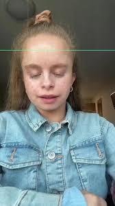 Imogen and Amelia Hall Dwarf Twins