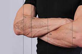 Our state of the art quanta q plus laser system (the best triple laser system available) and trained tattoo removal technicians will restore your look without crushing your budget! Laserall Safe Laser Hair Tattoo Removal In Colorado