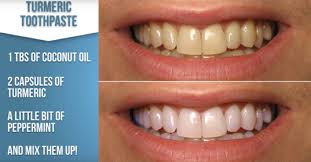 Learn how to whiten your teeth at home using homemade toothpaste and how to use this paste to make your teeth yellowish to sparkling white with step by step. 15 Super Easy Homemade Teeth Whitening Remedies To Get Those Pearly Whites Back