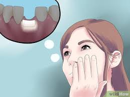 Untreated periodontal disease can lead to bone loss in the supporting jawbone. 3 Ways To Reverse Dental Bone Loss Wikihow