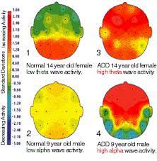 Doesn't it make sense to focus directly on the problem? Pin On Additude