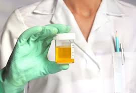 This may apply to you if you are a male as well. White Blood Cells In Urine What It Means