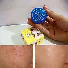 Kem Nghệ Q Care Co Tốt Khong Nghệ