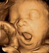 6 Mois De Grossesse Vous Et Bebe A 6 Mois De Grossesse