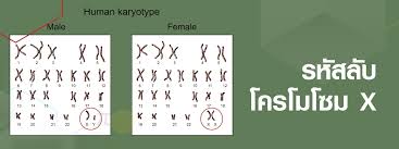Most eukaryotic chromosomes include packaging proteins called histones which, aided by chaperone proteins, bind to and condense the dna molecule to maintain its integrity. à¸£à¸« à¸ªà¸¥ à¸šà¹‚à¸„à¸£à¹‚à¸¡à¹‚à¸‹à¸¡ X
