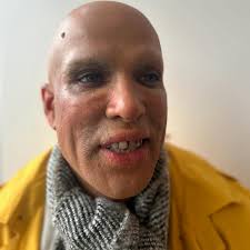 The big Gay Ball- Success. I waited 6years to wear this dress by Benjamin  Toner. Hair slayed by Diane Holmes. Huge love to you all xoxo