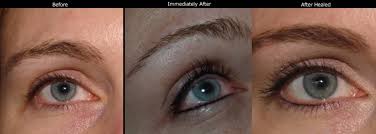 Permanent Eyeliner Photos Los Gatos Bay Area Timeless Skin Spa
