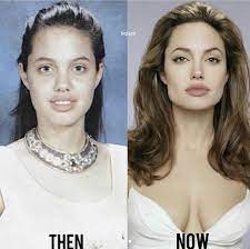 Actress angelina jolie announced today that she underwent a preventative double mastectomy after learning she is at a high risk of developing breast cancer. 8 Angelina Jolie Plastic Surgery Ideas Angelina Jolie Angelina Angelina Jolie Plastic Surgery